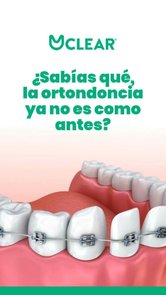 Uclear El Salvador Facebook ad: Usaste molestos brackets, pero tus dientes se movieron…