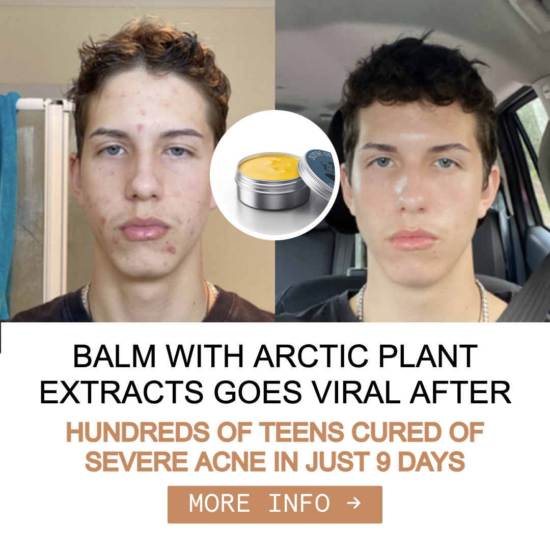 Anne's Skincare Blog Facebook ad