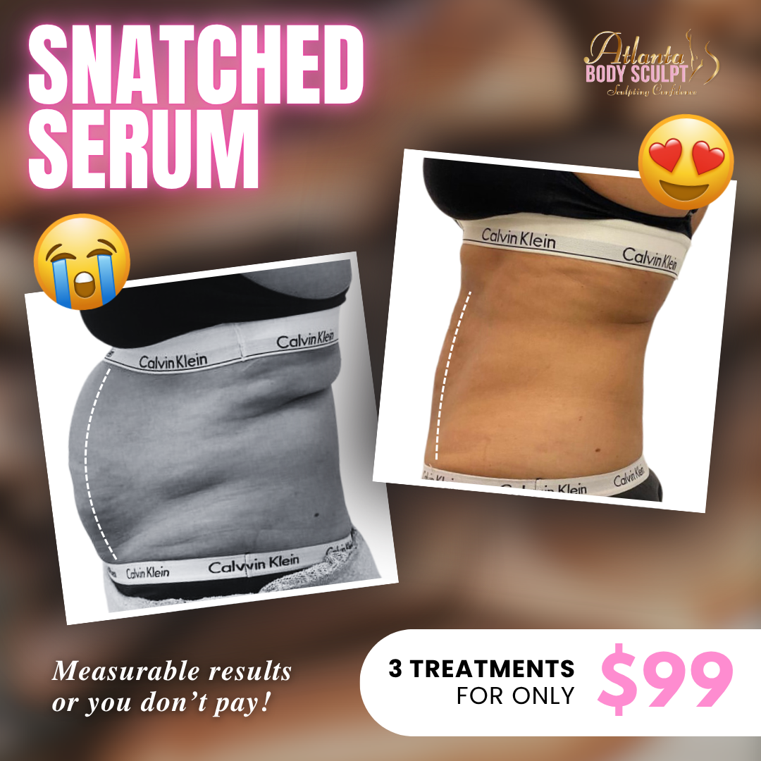 Atlanta Body Sculpt Facebook ad
