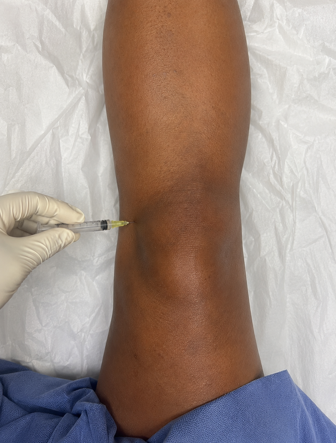 Barbara Carter Facebook ad: What your orthopedic surgeon isn't telling you about bone…