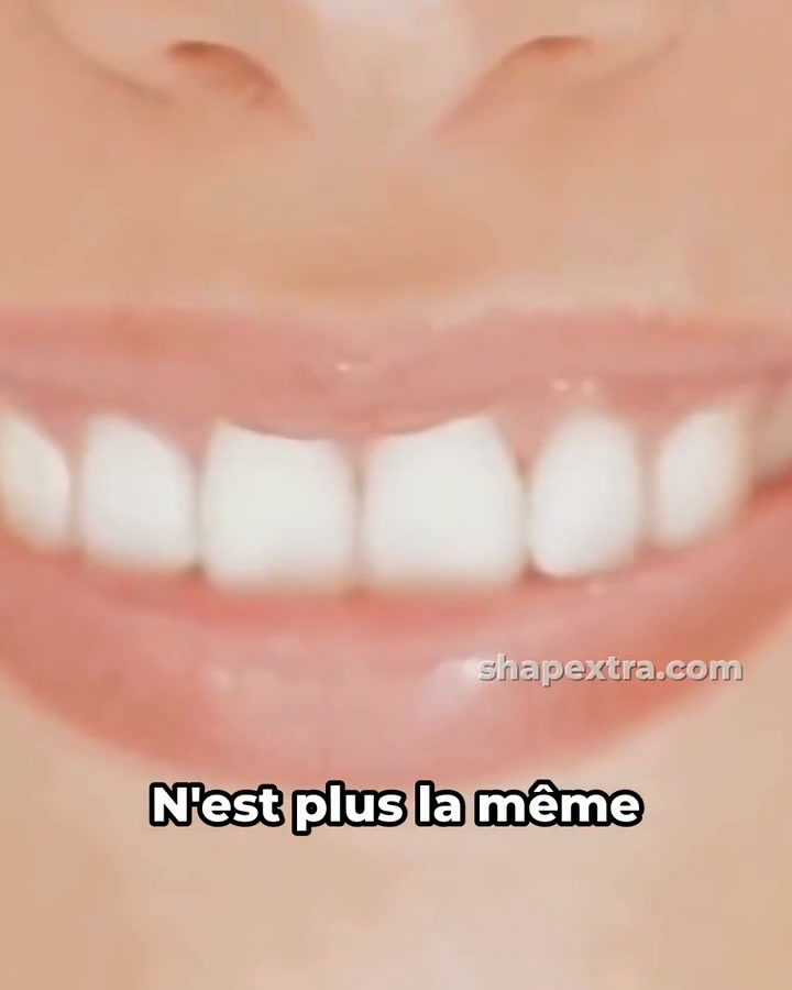 Shapextra Facebook ad: Des dents propres en 1 minute