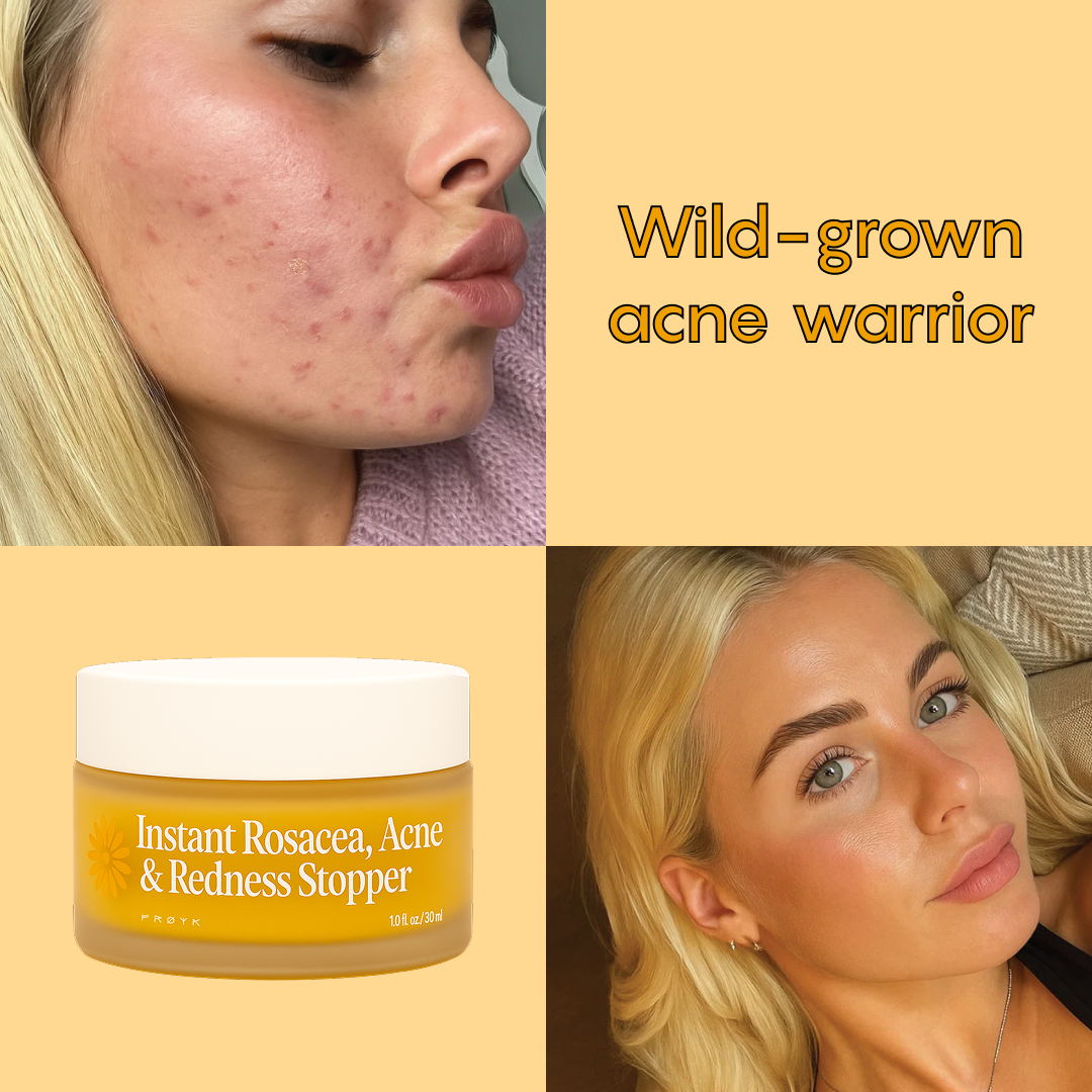 Frøya Organics Facebook ad