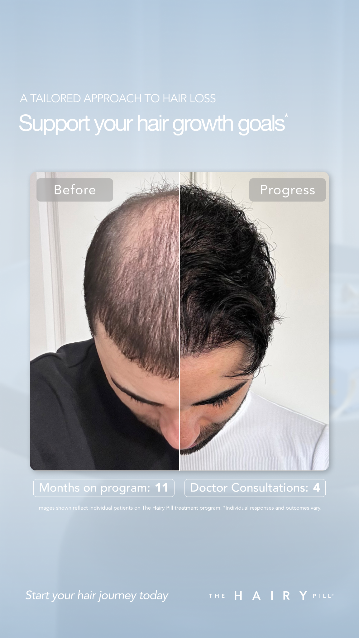 The Hairy Pill Facebook ad