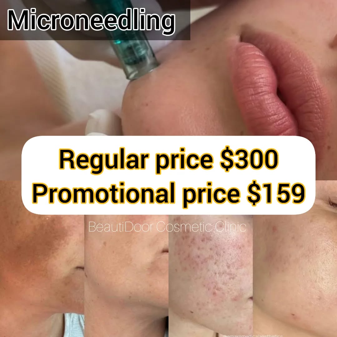 BeautiDoor Facebook ad: Microneedling at BeautiDoor Cosmetic Clinic