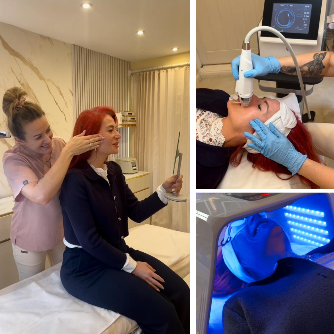 The Village Beauty - Aesthetic Clinic, skin & Laser Treatments Facebook ad
