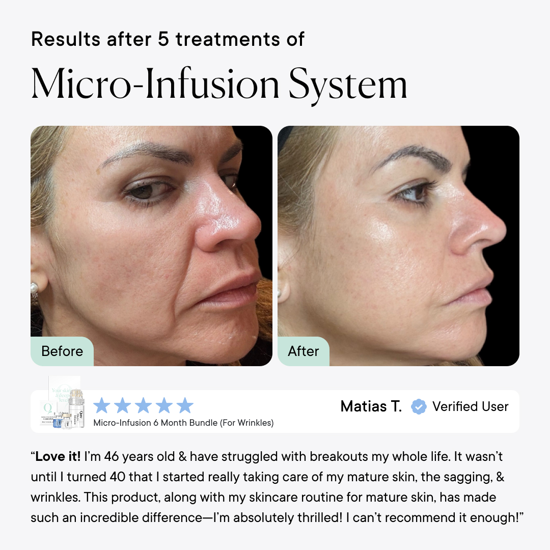 Qure Skincare Facebook ad