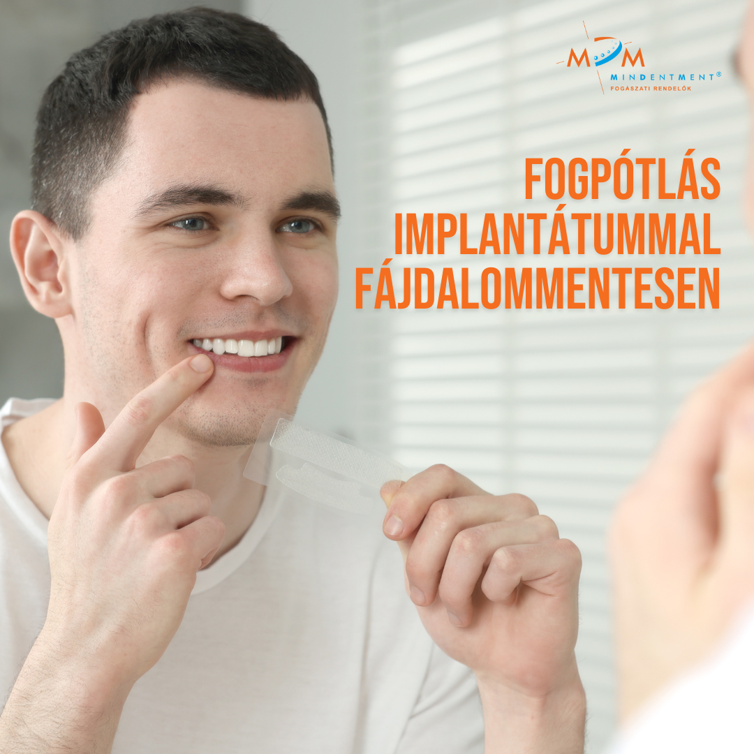 MindentMent Fogászati Rendelő Facebook ad
