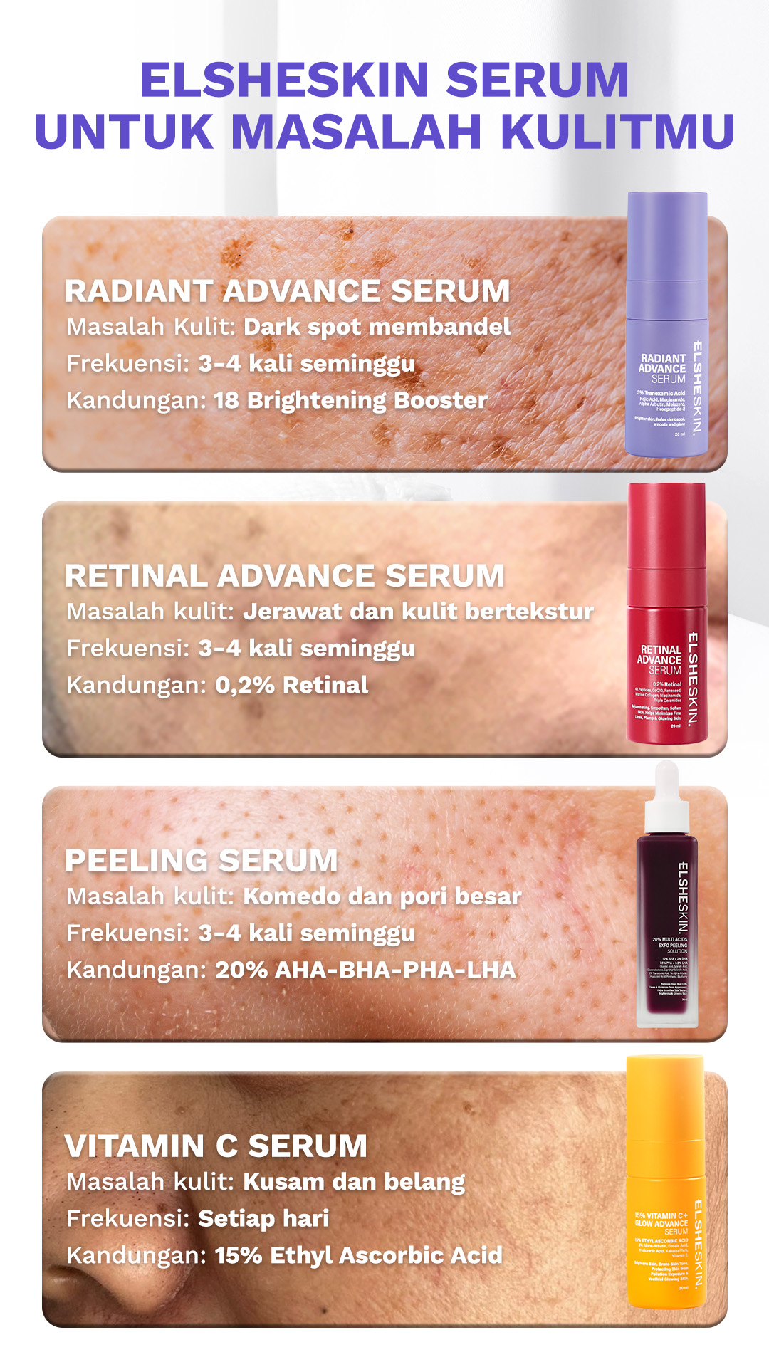 Elsheskin Facebook ad