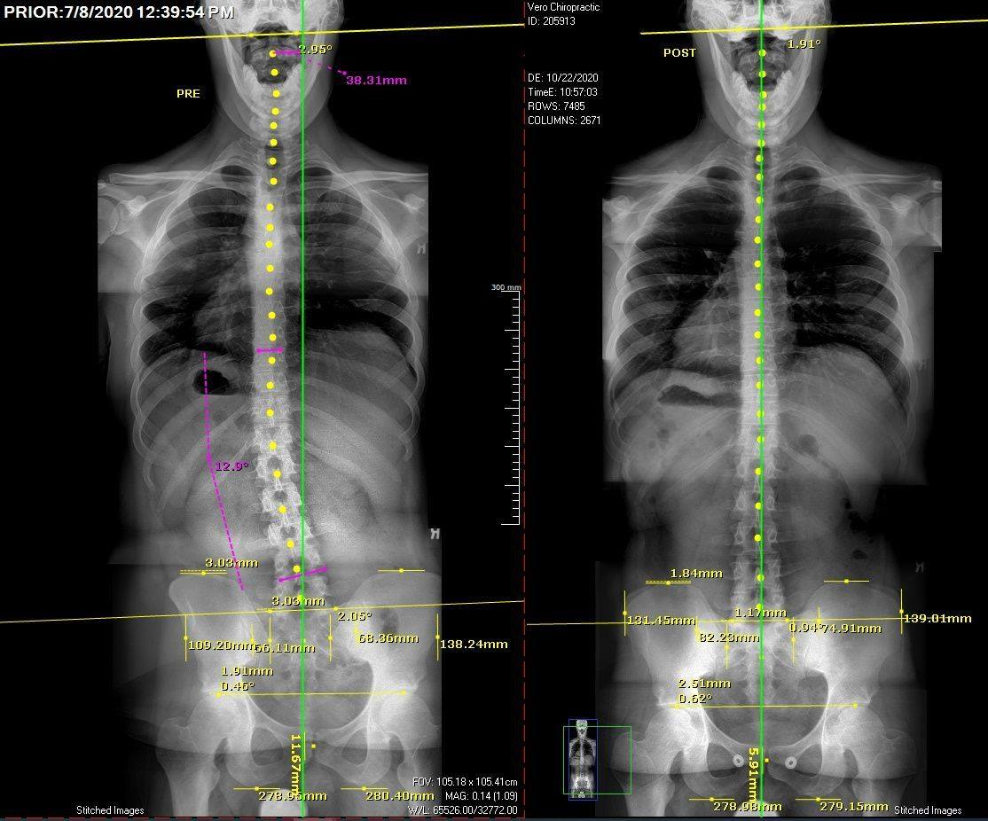 Vero Health Center Facebook ad: Polk County's Trusted Alternative to Surgery
