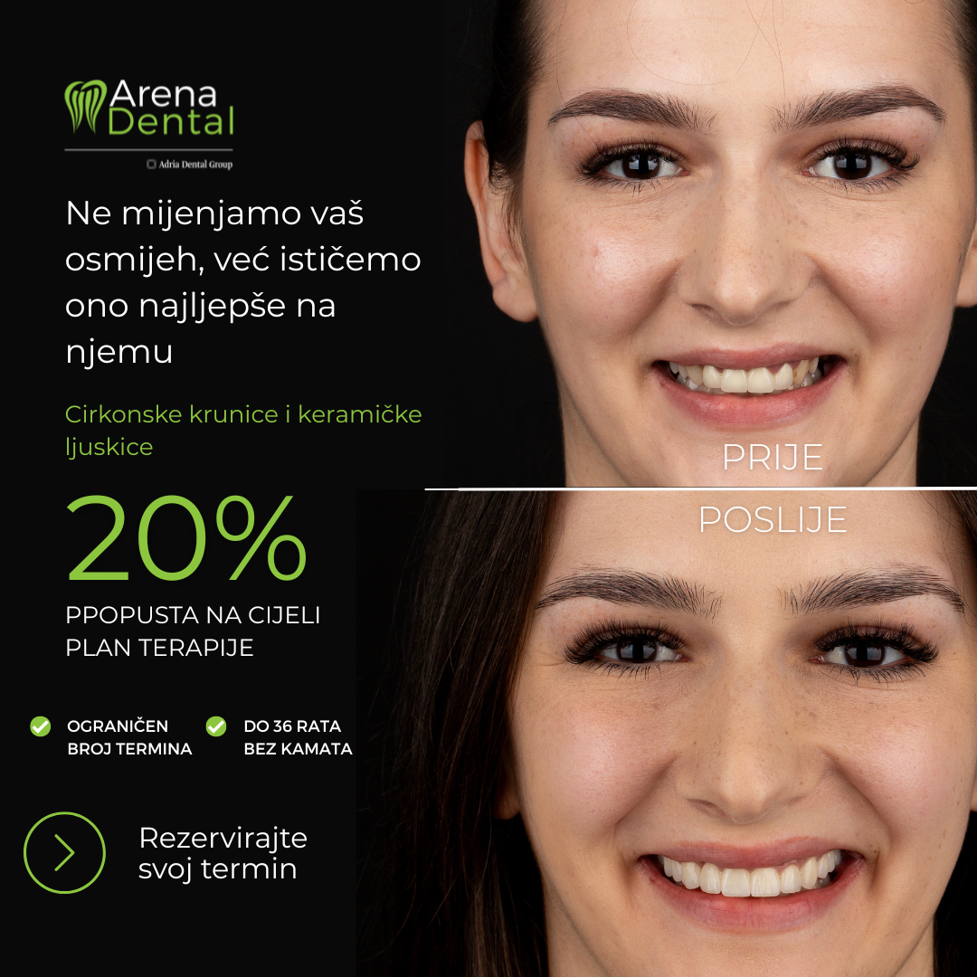 Arena Dental Facebook ad