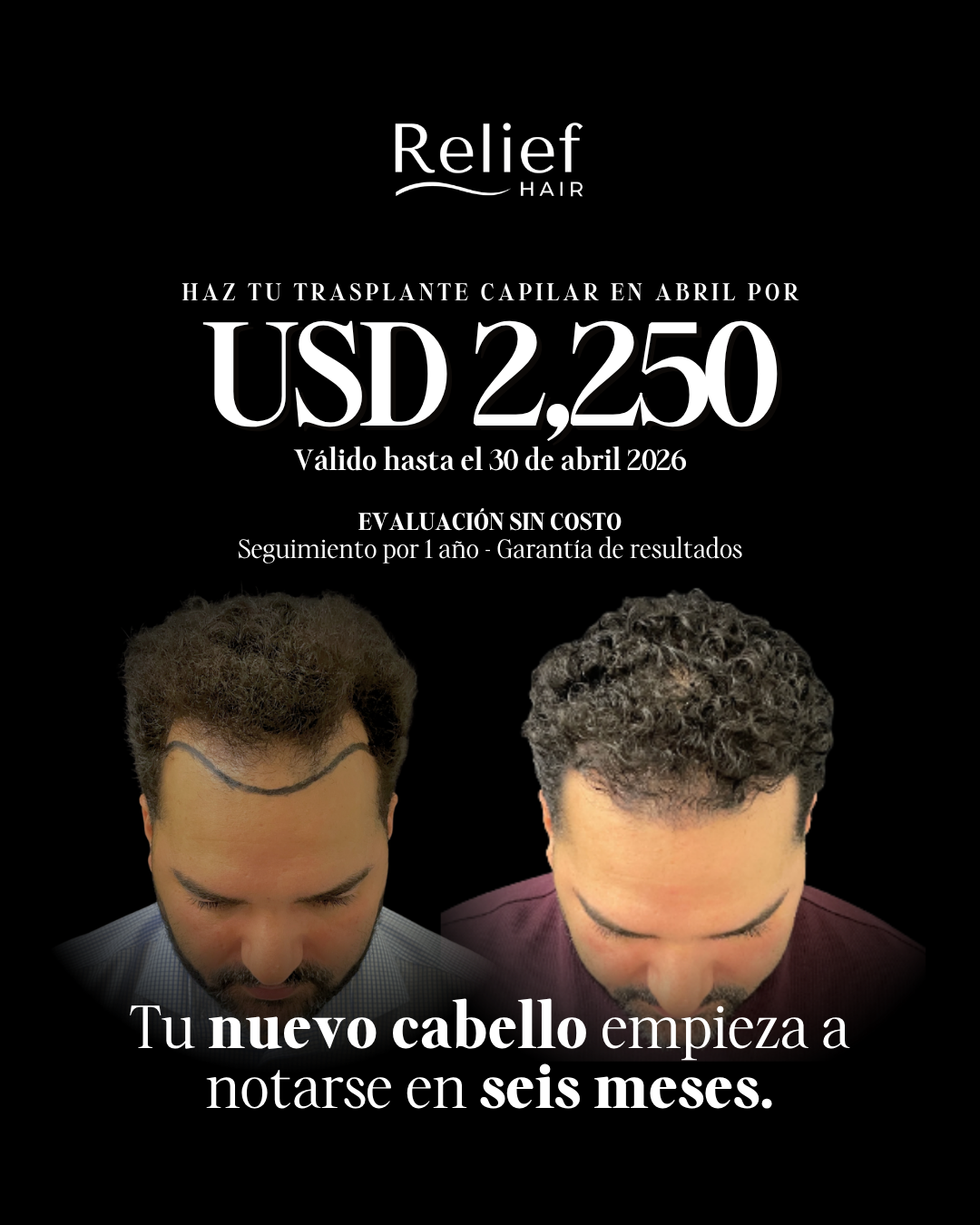 Relief Hair Facebook ad from Apr 2, 2026