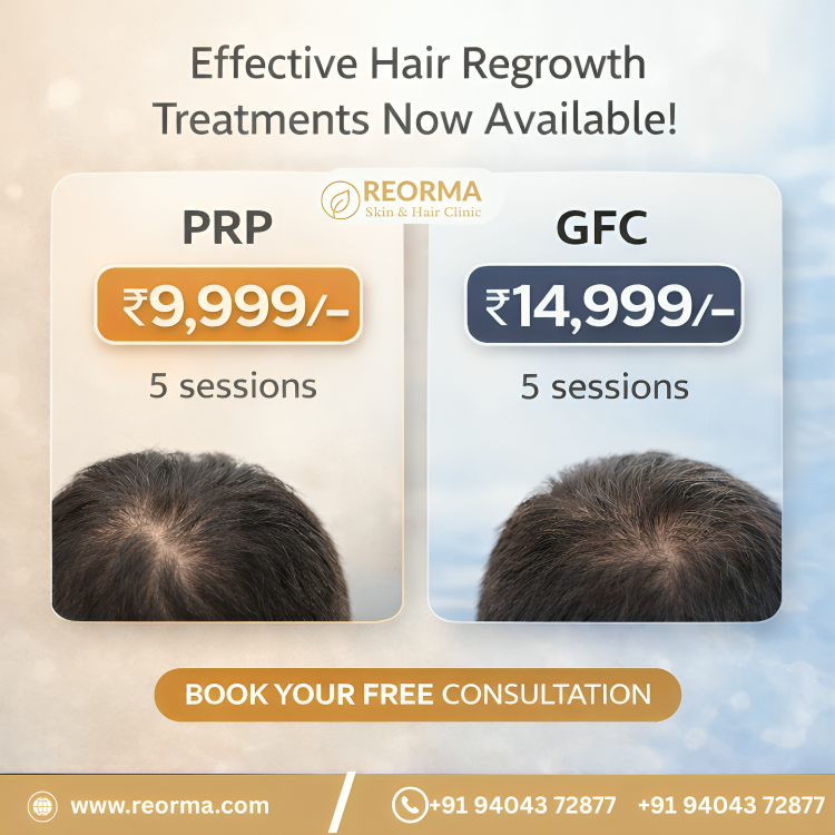Reorma Skin & Hair Clinic Facebook ad: PRP & GFC Hair Treatment Offers