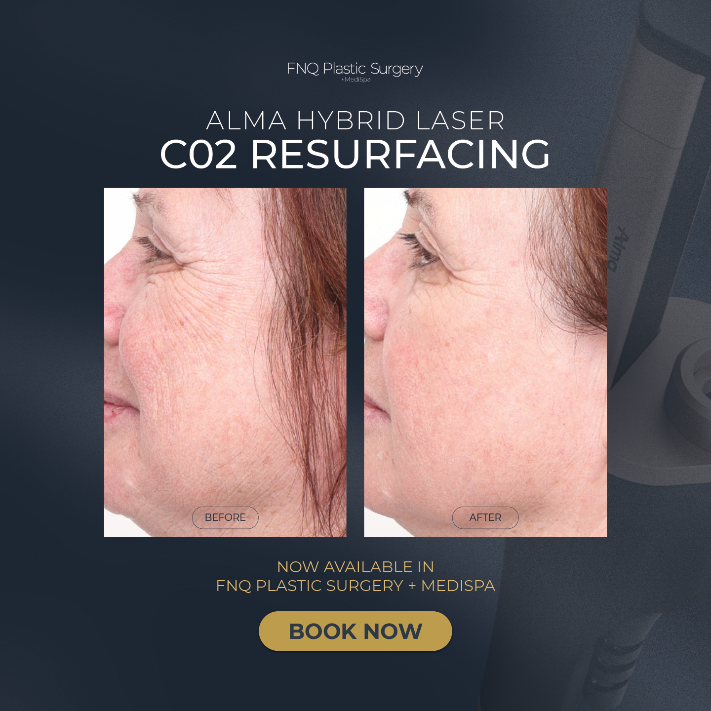 FNQ Plastic Surgery & MediSpa Facebook ad