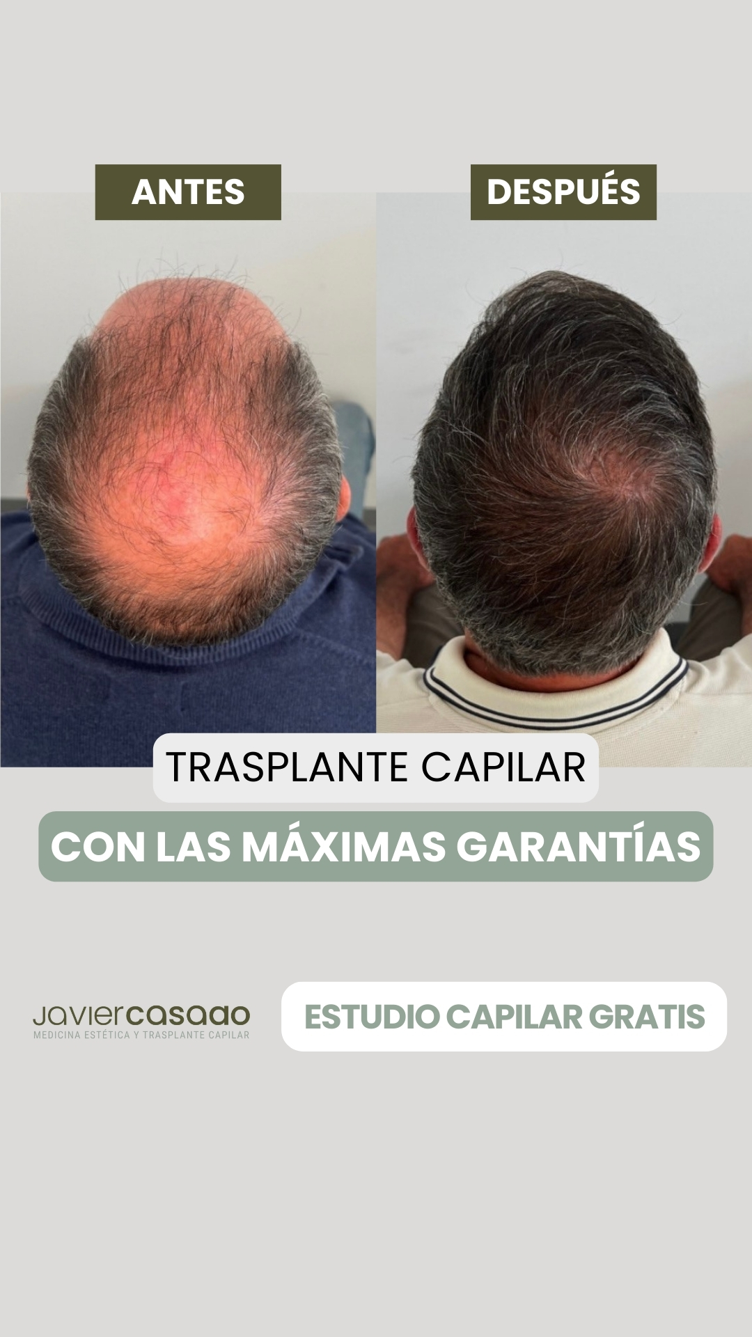 Dr. Javier Casado Facebook ad from Feb 4, 2026