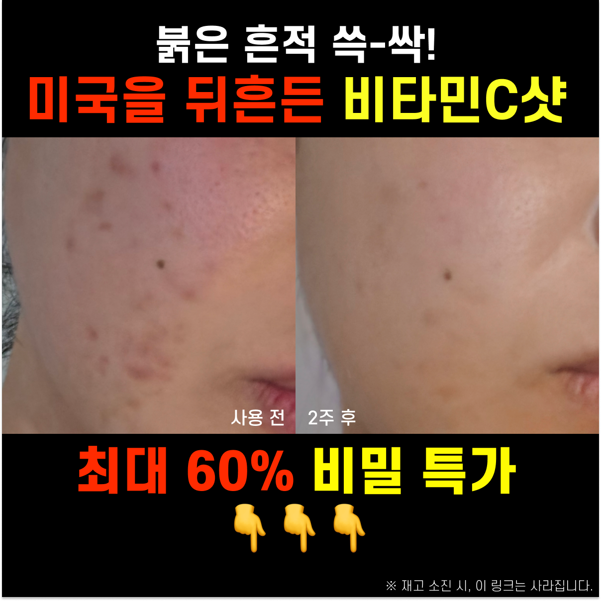 요즘핫템 Facebook ad: 미국을 뒤흔든 한국 약국템