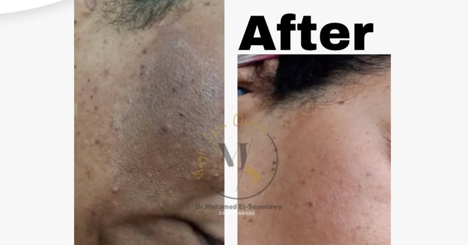Magic skin clinics Facebook ad