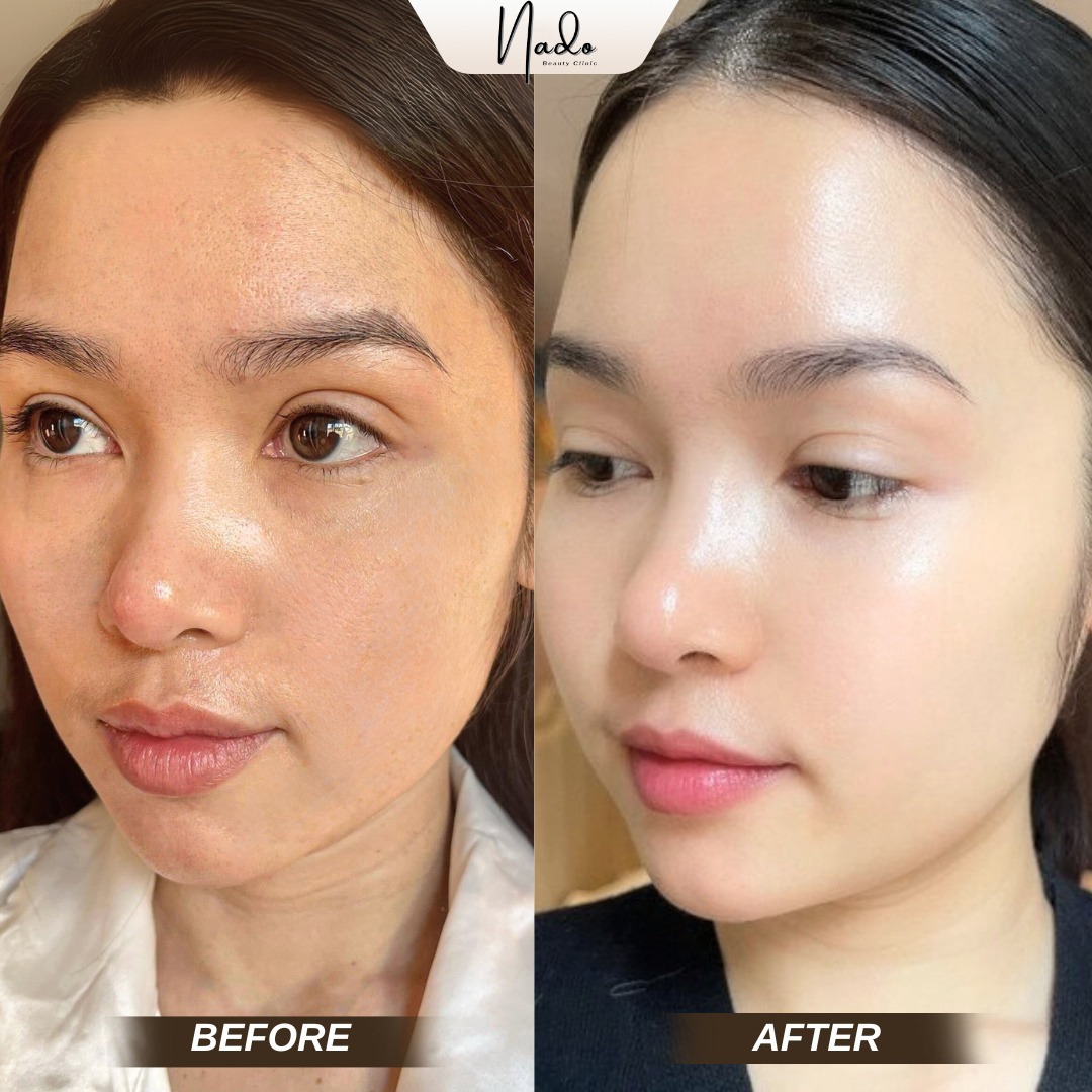Huyen beauty Facebook ad: Revitalize Your Skin from Within!