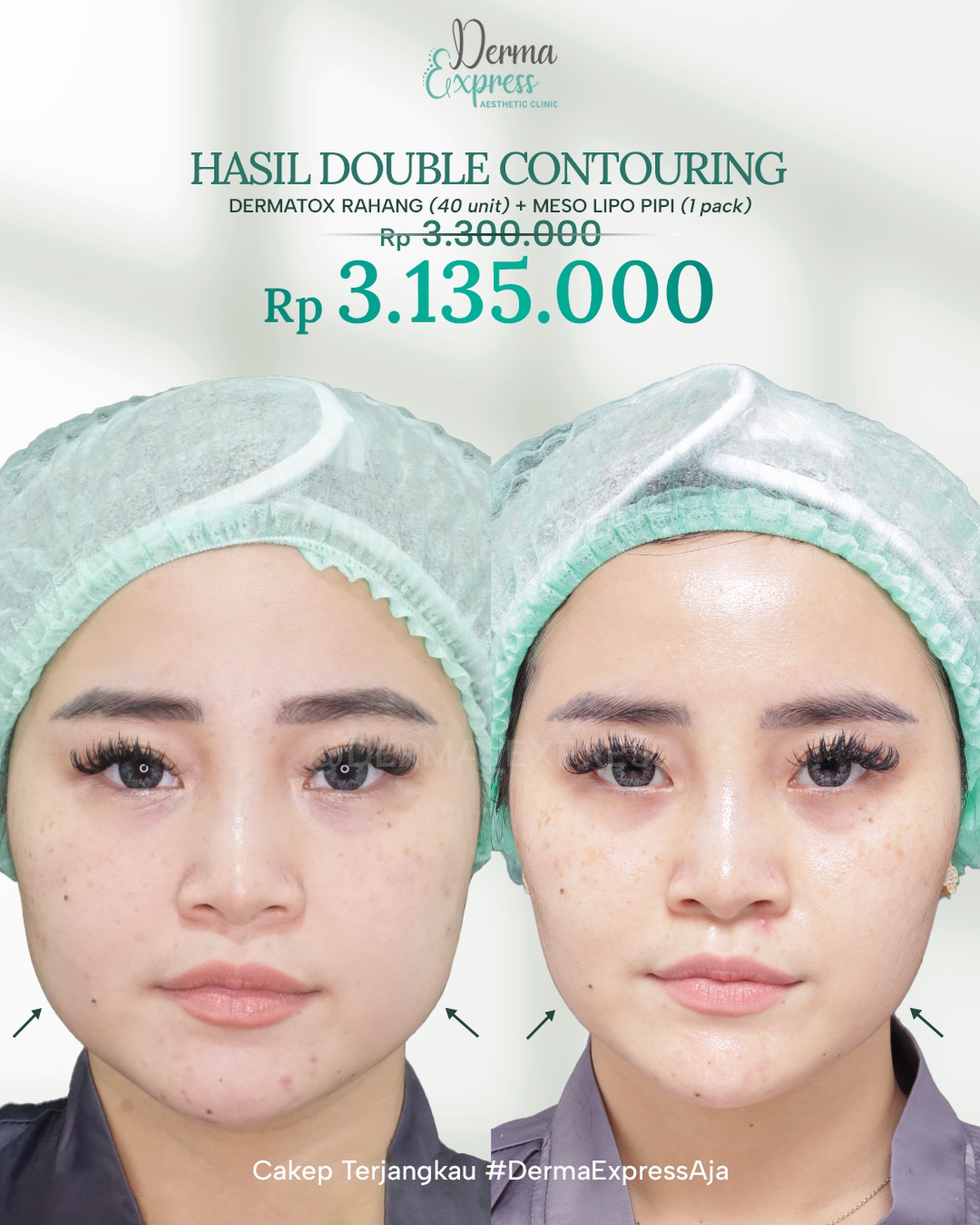 derma_express Facebook ad