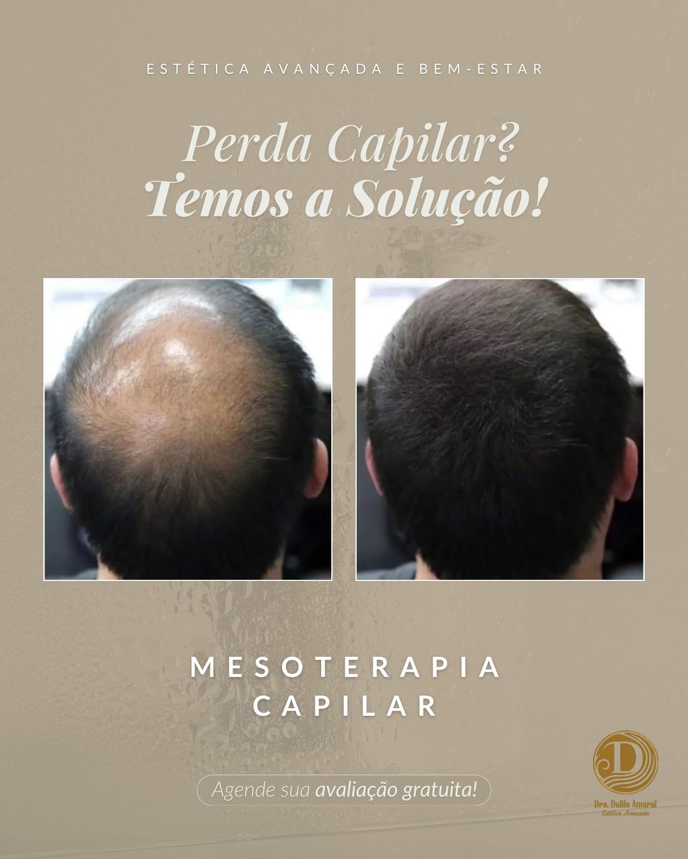 clinicadalilaamaral Facebook ad: Notou mais fios caindo que o normal?