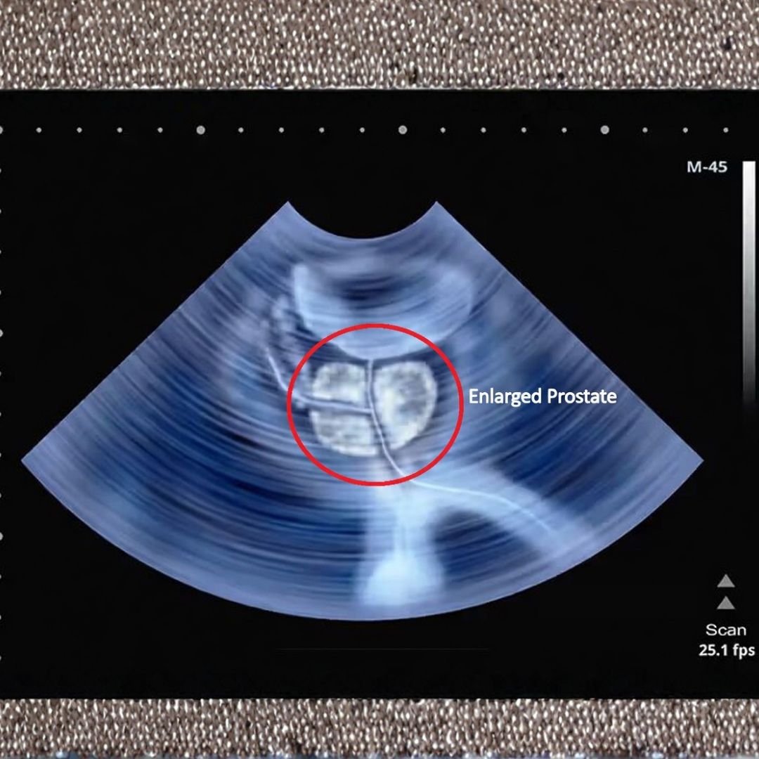 Prostate Health Secrets Facebook ad