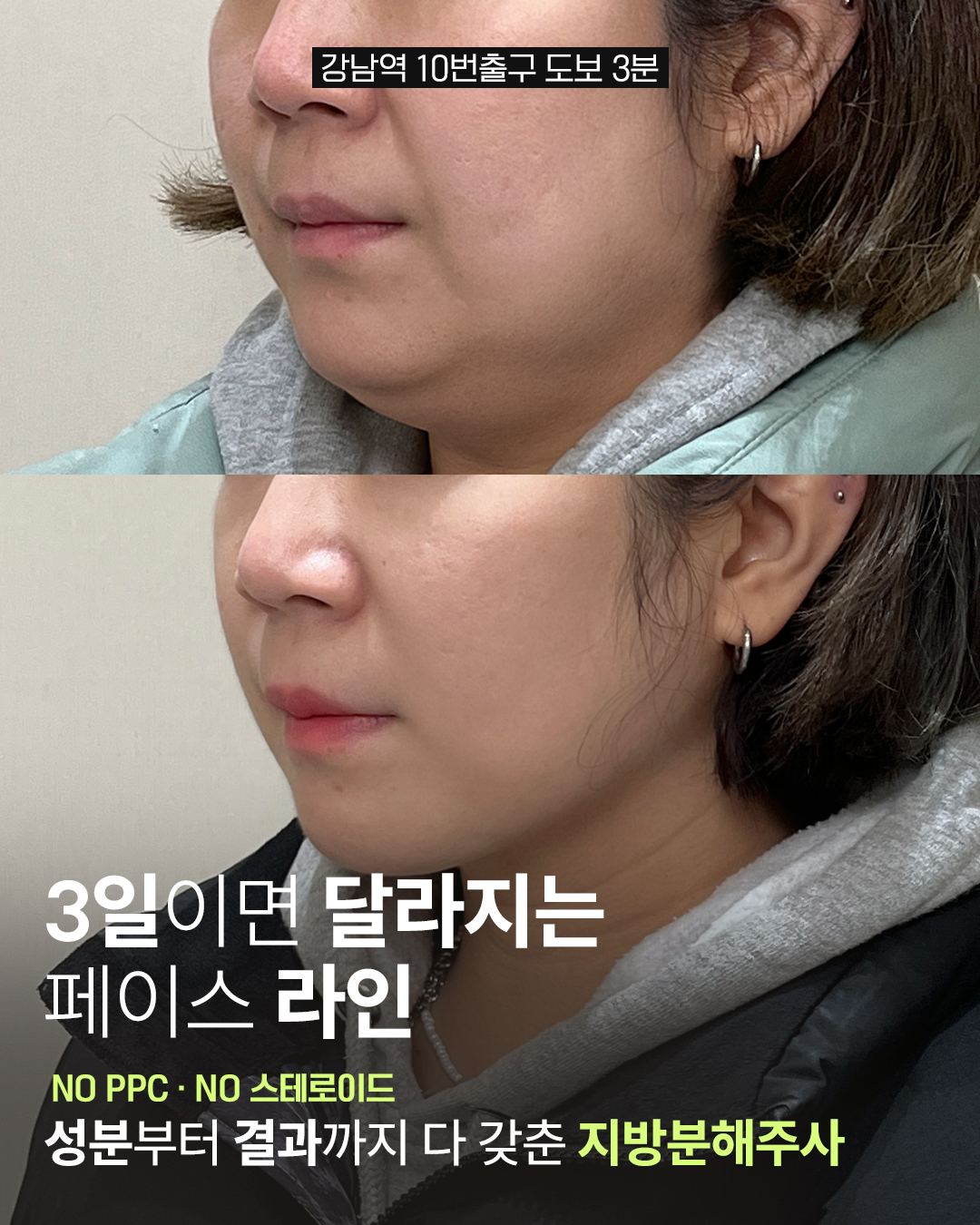 뷰티컨설팅 Facebook ad: 오늘까지만 한정 특가!