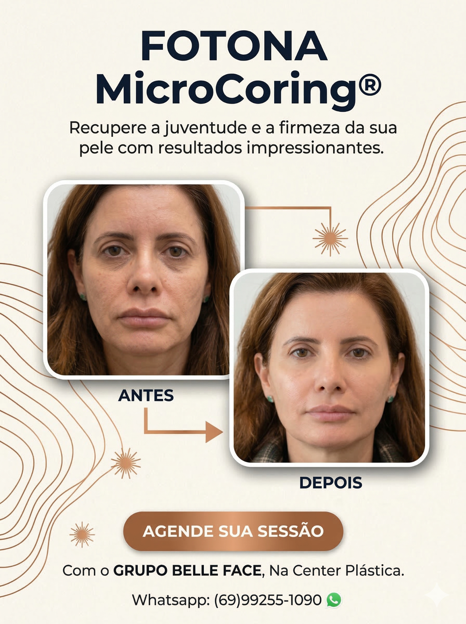 Grupo Belle Face Facebook ad from Apr 11, 2026