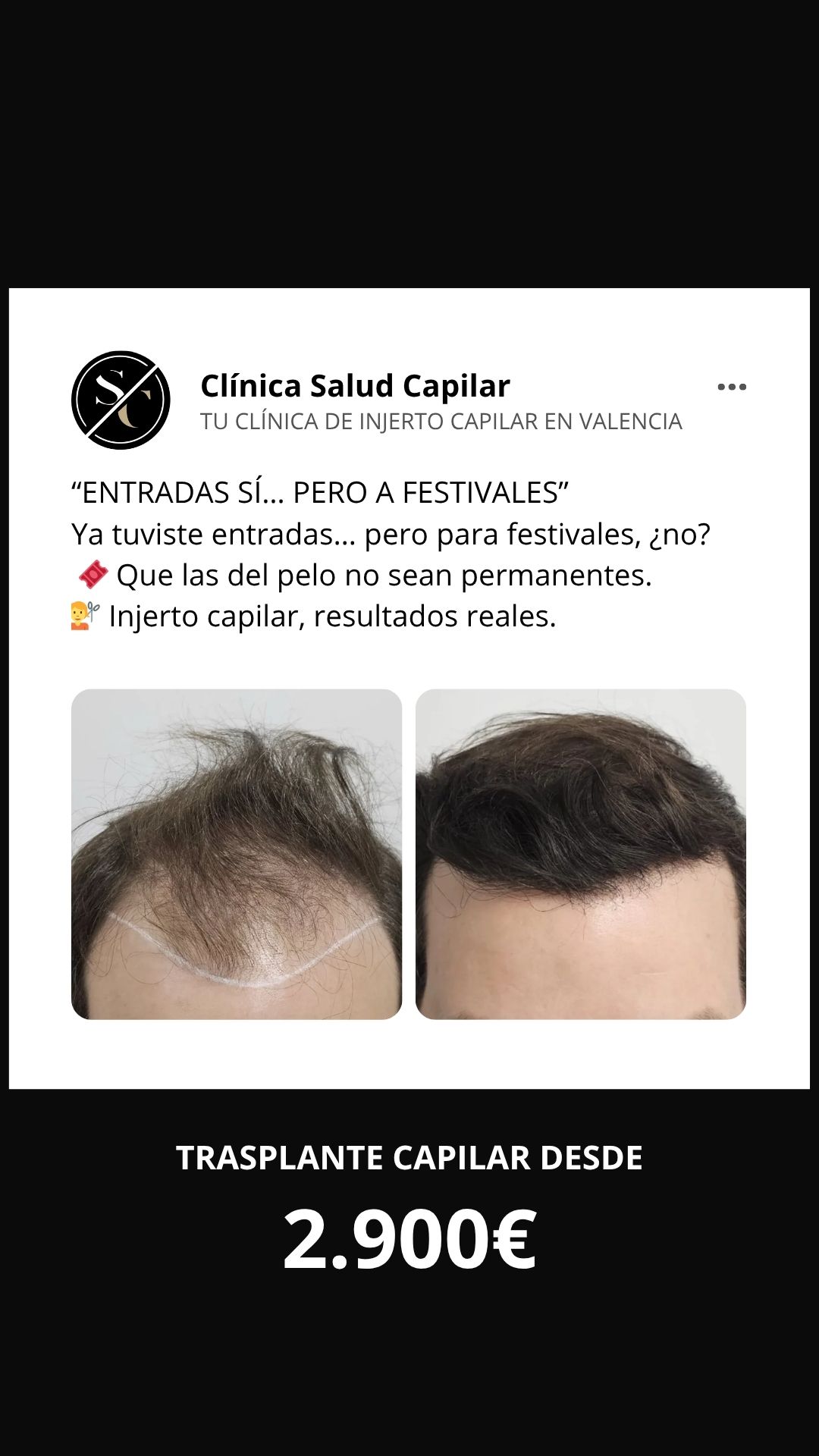 Clínica salud capilar  Facebook ad