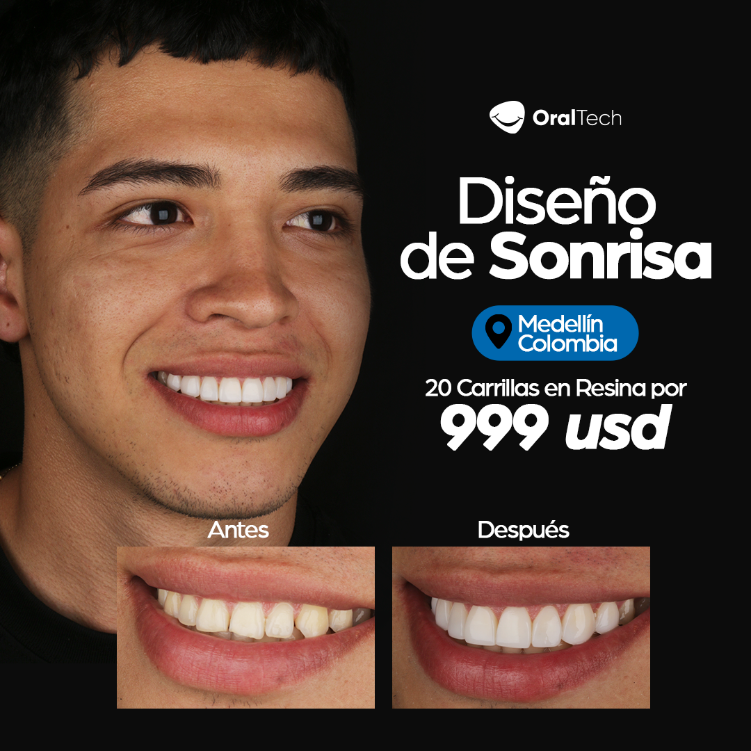 Oral Tech Clinica Dental Facebook ad from Aug 5, 2025