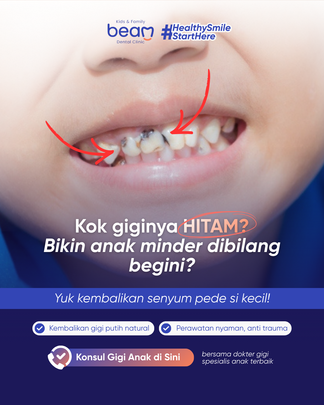 Beam Dental Clinic Facebook ad: Gigi Hitam Bikin Anak Minder?