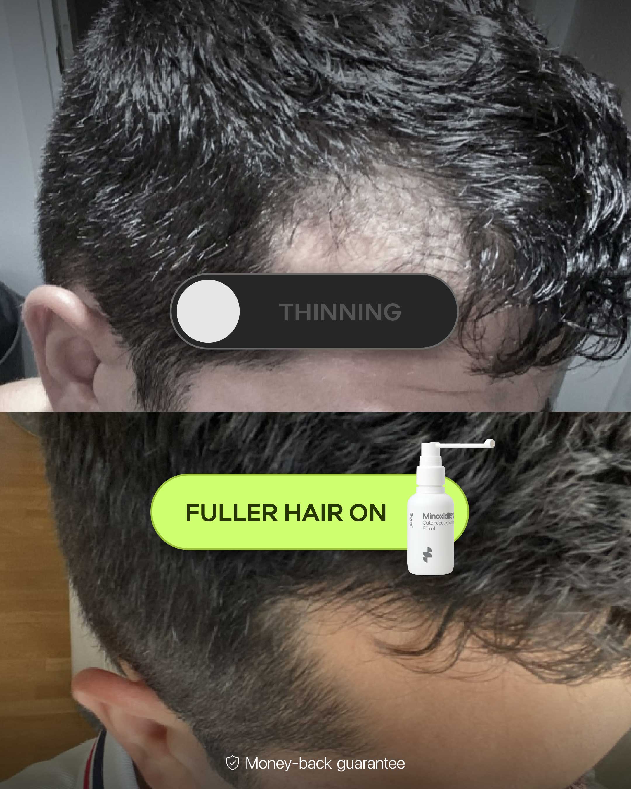 Sons Facebook ad: Get ahead of hair loss