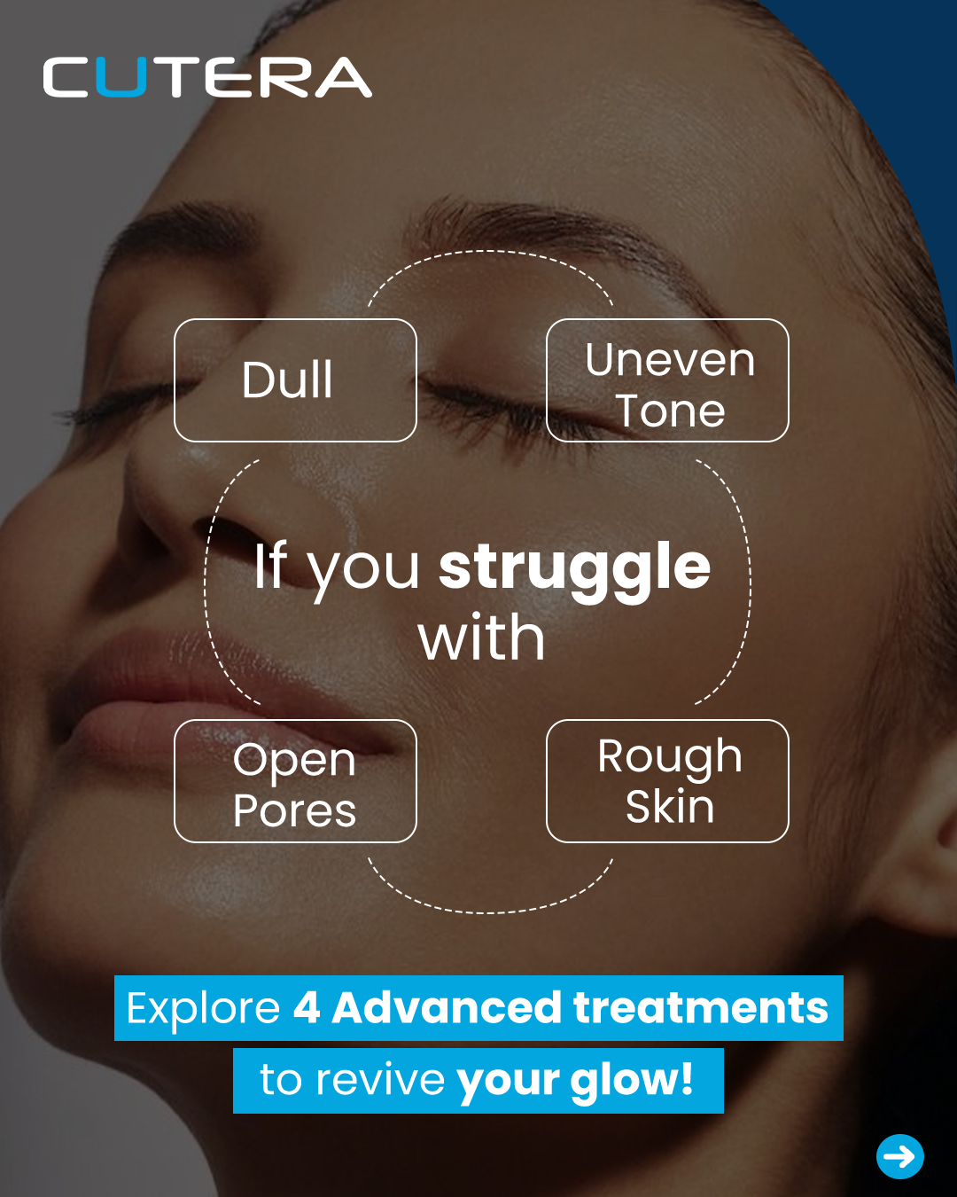 Cutera Aesthetics Facebook ad: Every mirror tells the same story: dull patches…