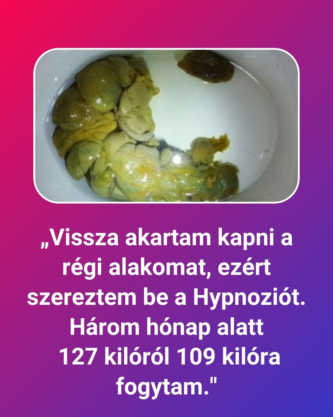 Hypnozio: power of hypnotherapy Facebook ad
