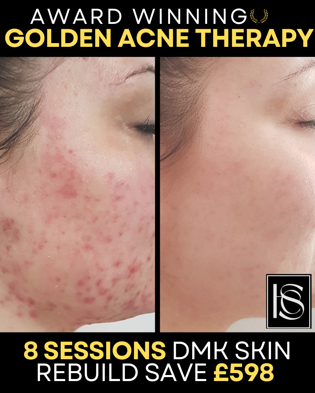 Hello Skin Clinic Facebook ad from Feb 3, 2026