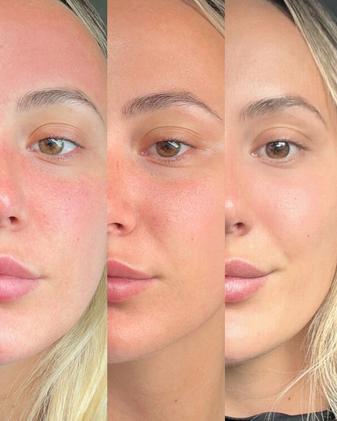 Contour Clinics Facebook ad