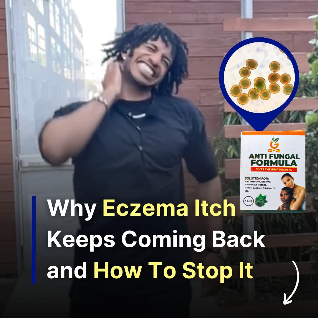 Fungal Natural Remedy Facebook ad