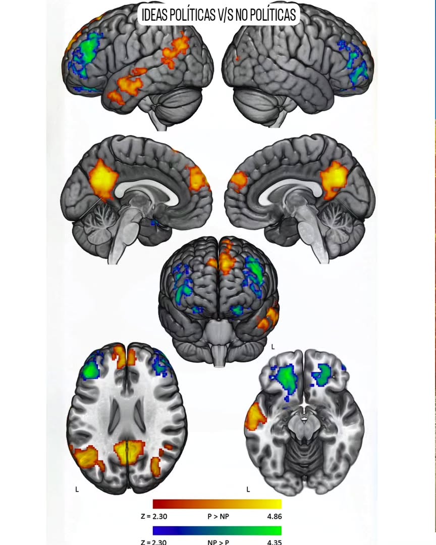 psiquiatra.alberto.covarrubias Facebook ad: ¿Cómo se defiende tu cerebro frente a argumentos…
