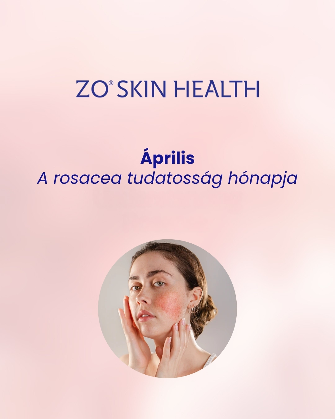 ZO Skin Health Magyarország Facebook ad