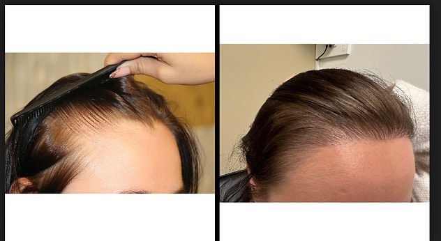 Modena Hair Institute Facebook ad