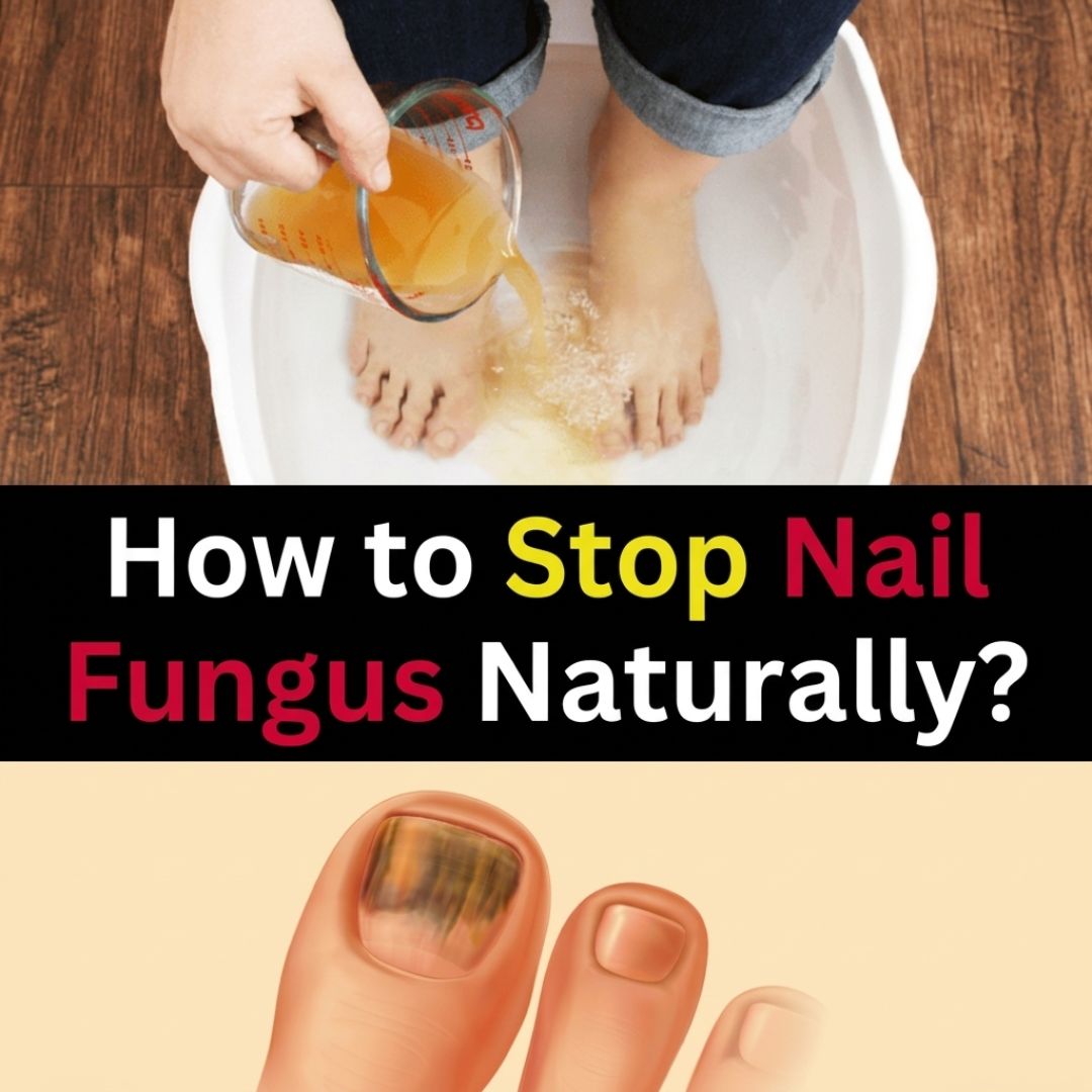 Health Focus Facebook ad
