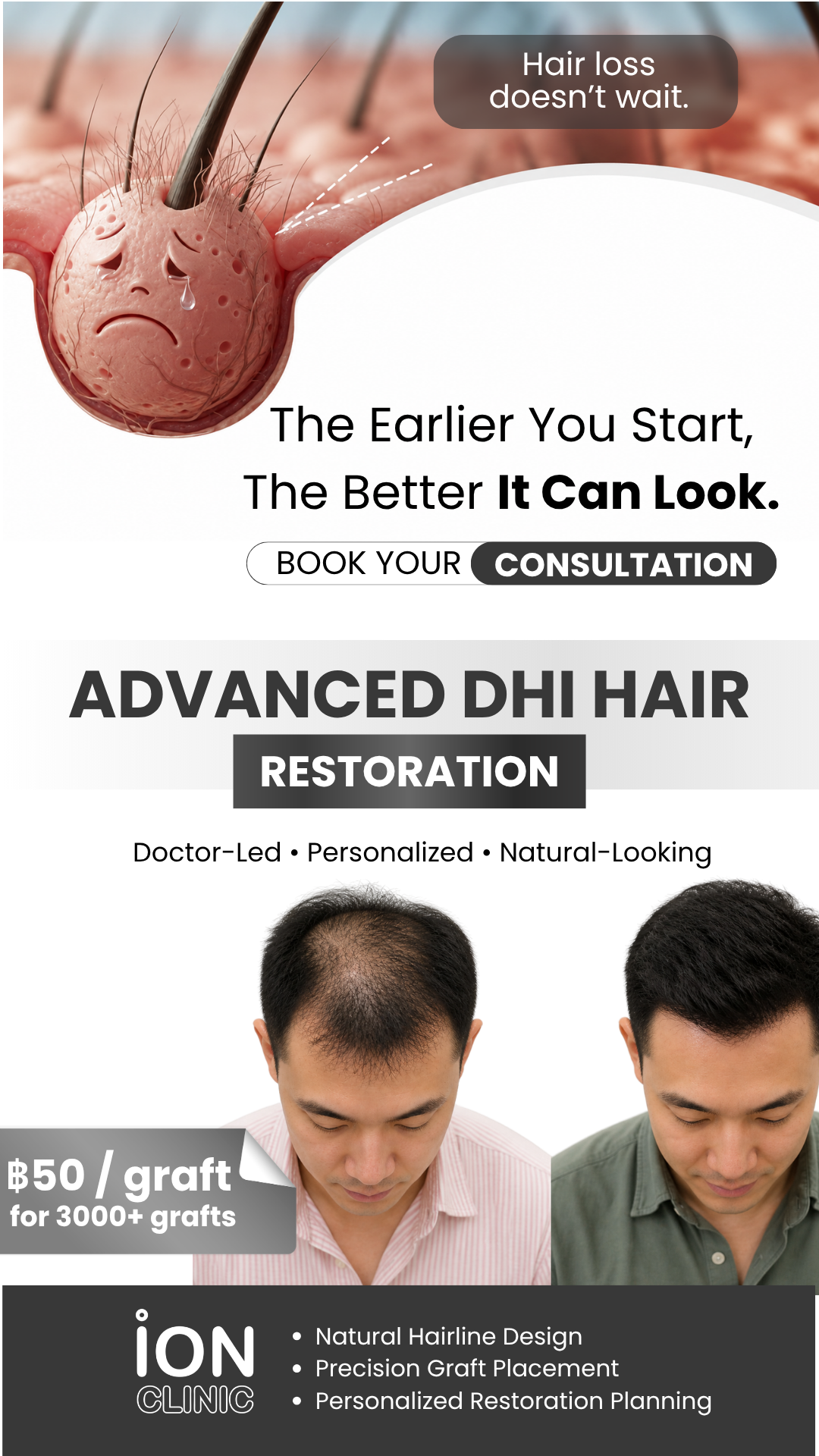 ION Clinic Bangkok Facebook ad
