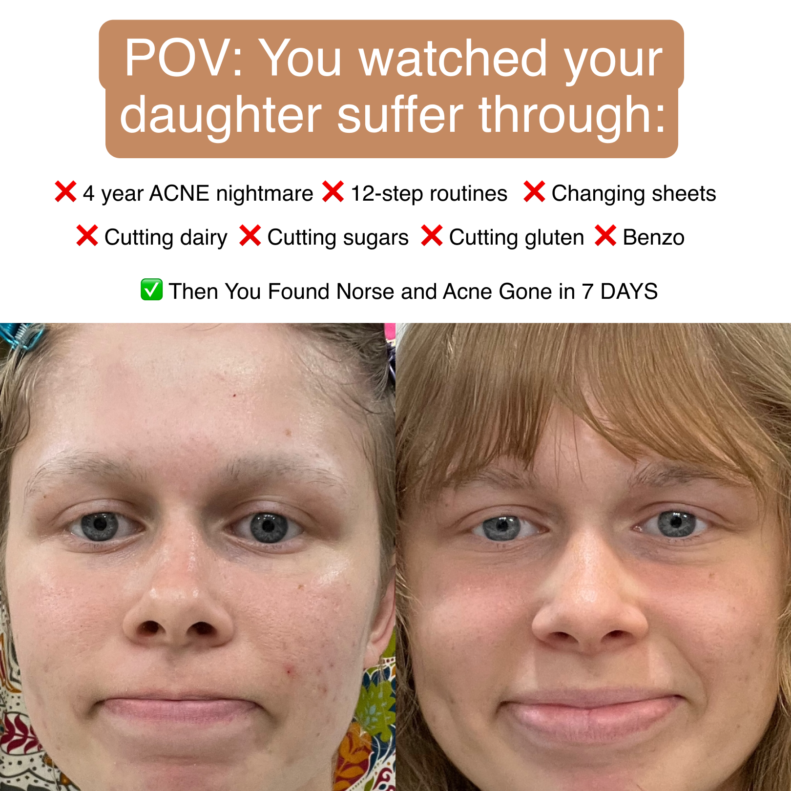Anne's Skincare Blog Facebook ad