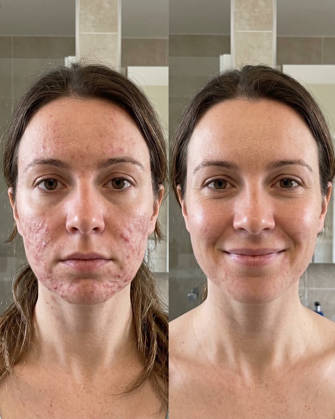 Primals Life Facebook ad: Stop your shower from triggering acne