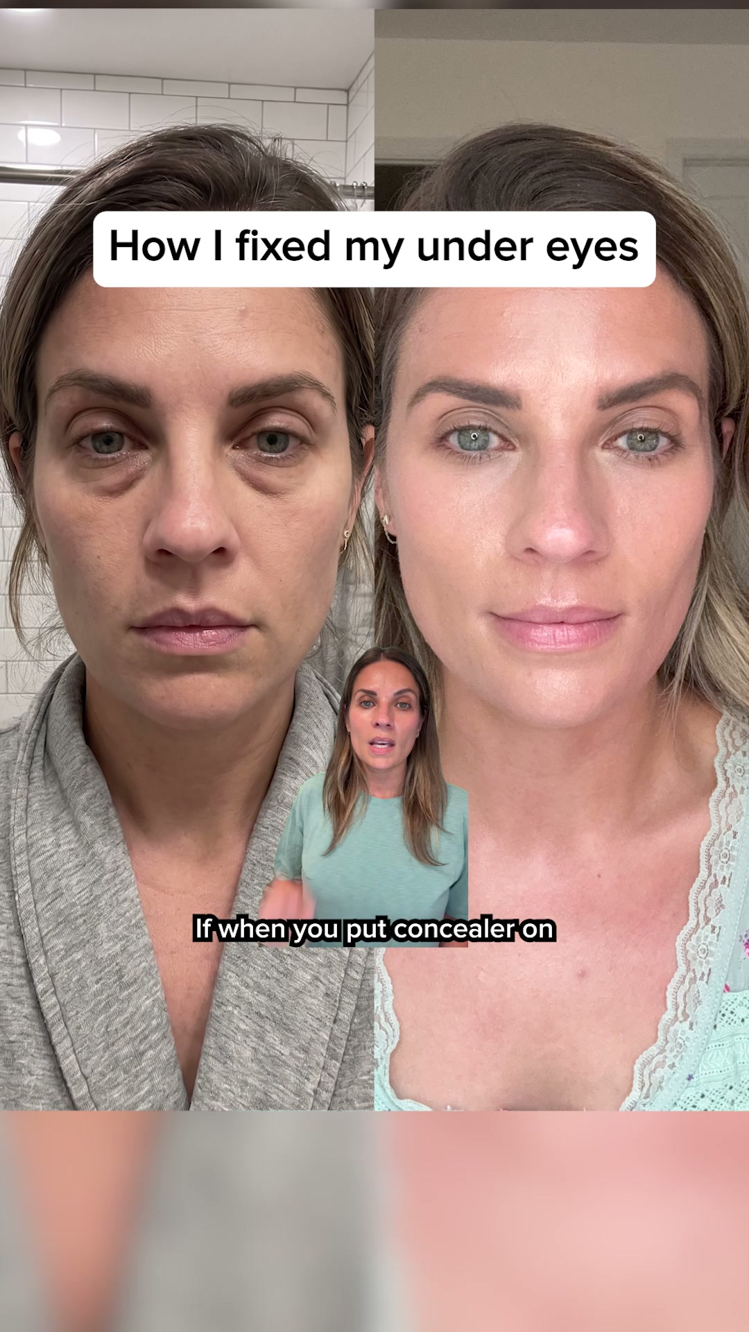 Based Supplies Facebook ad: Restore Your Skin in 3 Weeks!