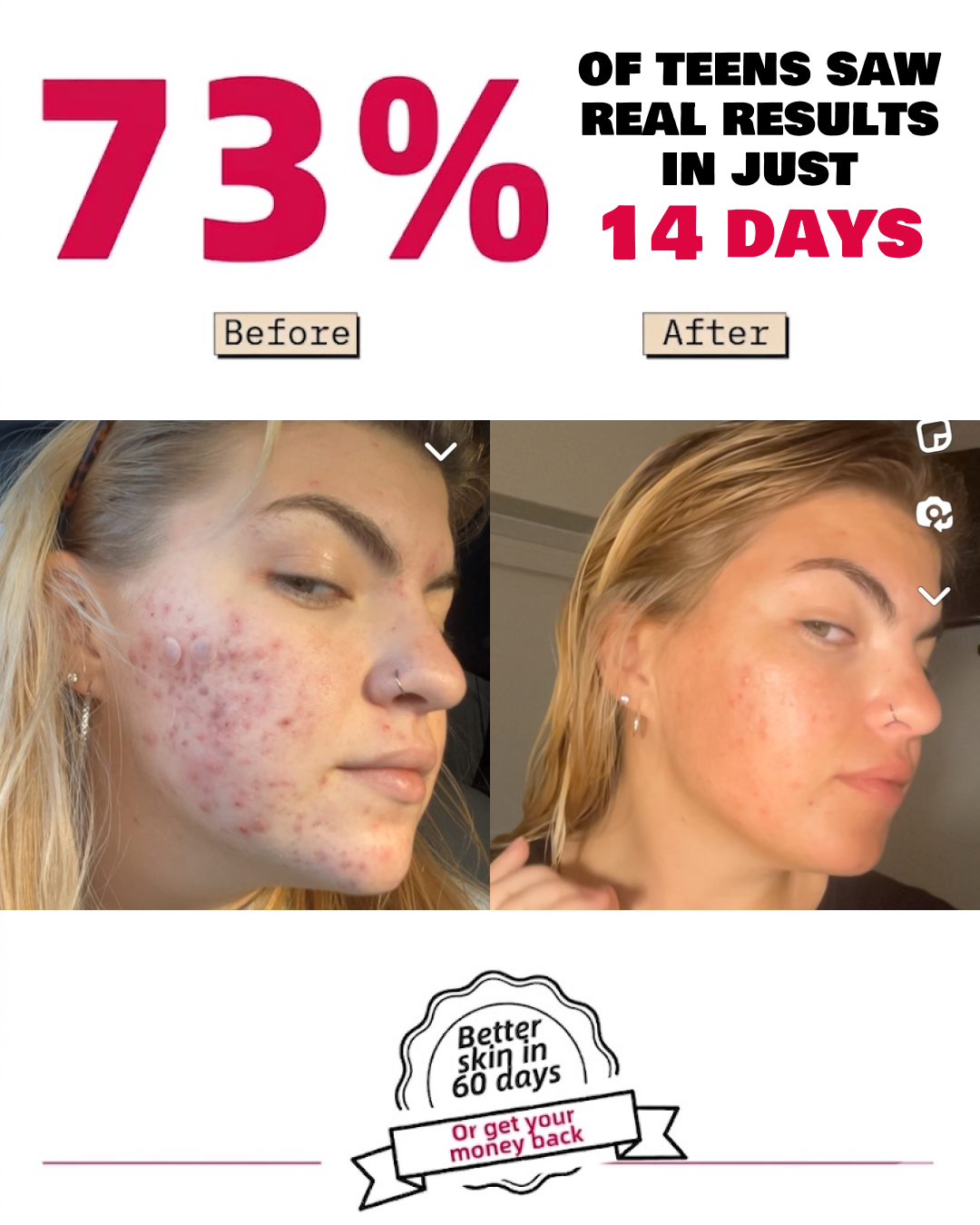 Anne's Skincare Blog Facebook ad