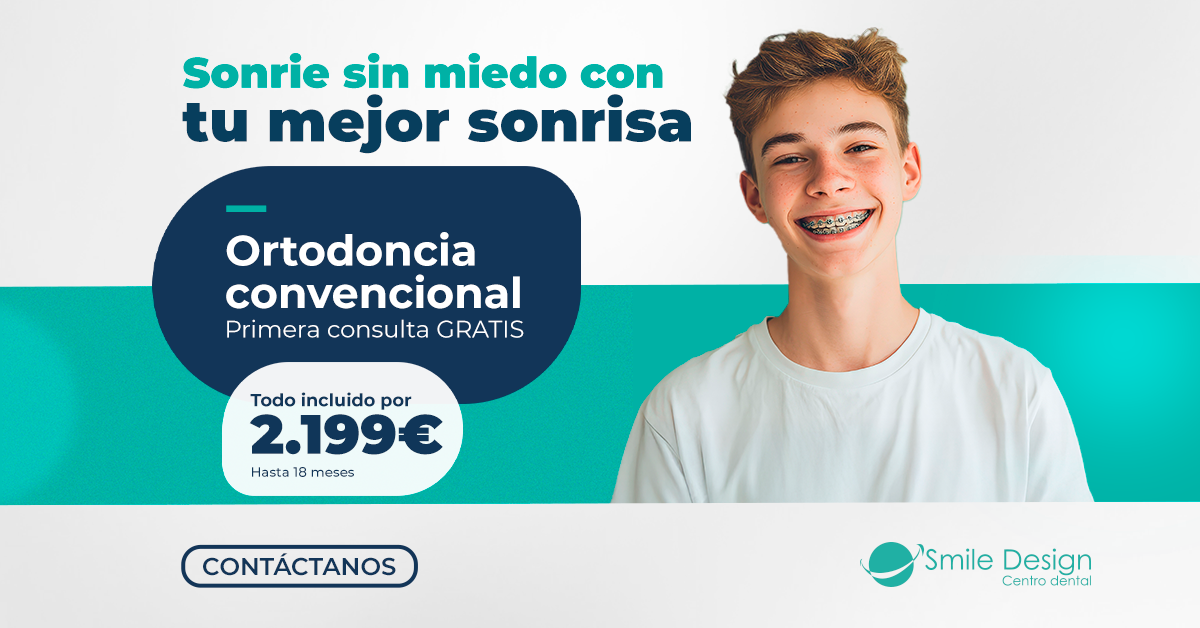 Smile Design Facebook ad