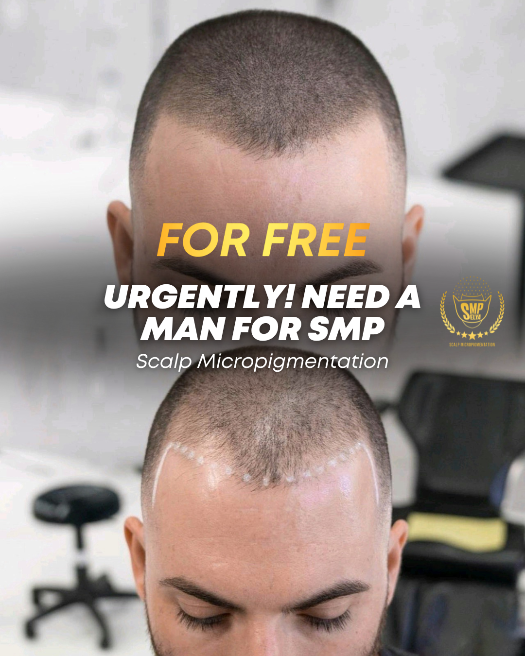 Сергей #Novoselya Facebook ad: MODEL NEEDED, FREE SCALP MICROPIGMENTATION
