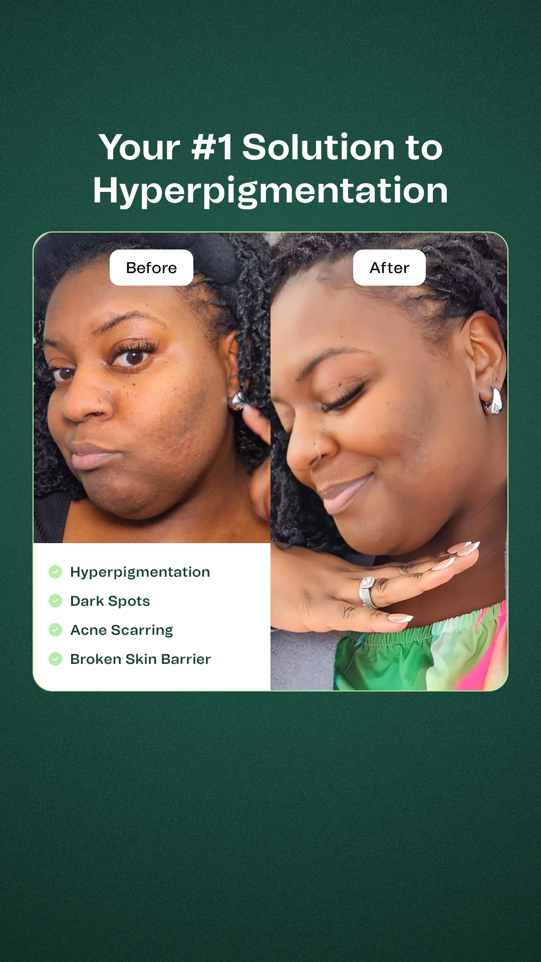 Hey Bud Skincare Facebook ad