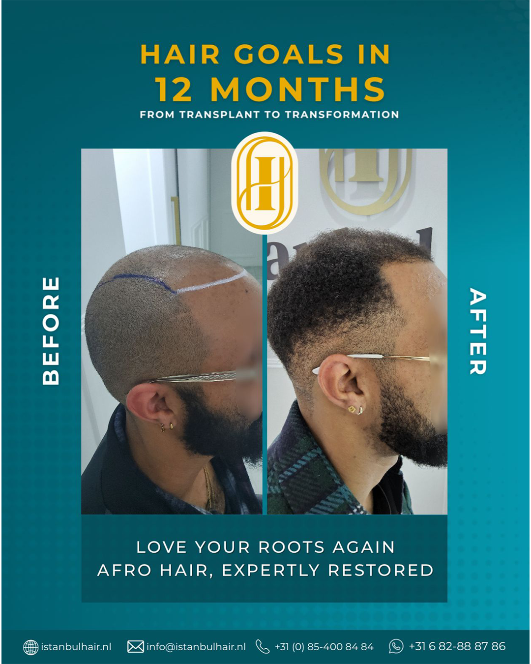 Istanbulhair Facebook ad from Aug 6, 2025