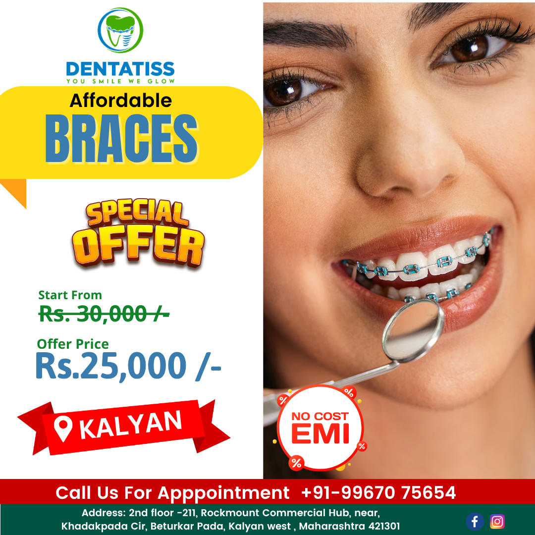 Dentatiss Facebook ad