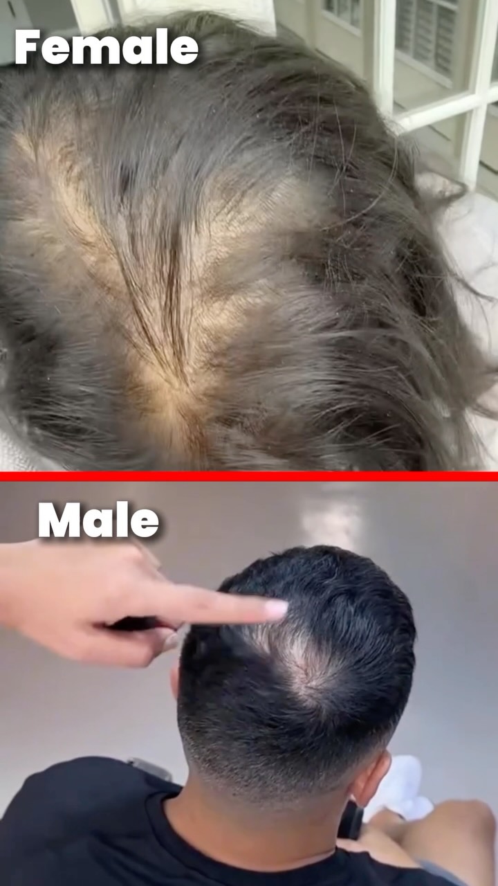 Bare Anatomy Facebook ad: Comment for product link
